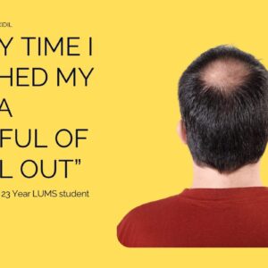 hair loss serum chubby hair by sabbskin