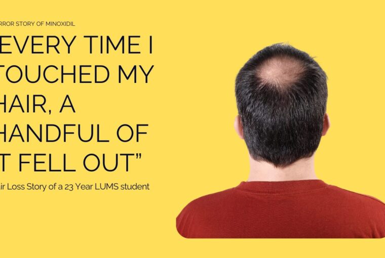 hair loss serum chubby hair by sabbskin